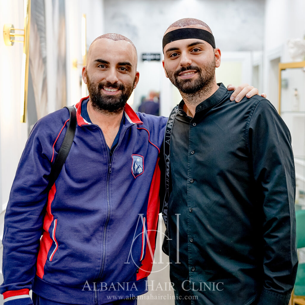 Trapianto Di Capelli | Albania Hair Clinic gallery photo