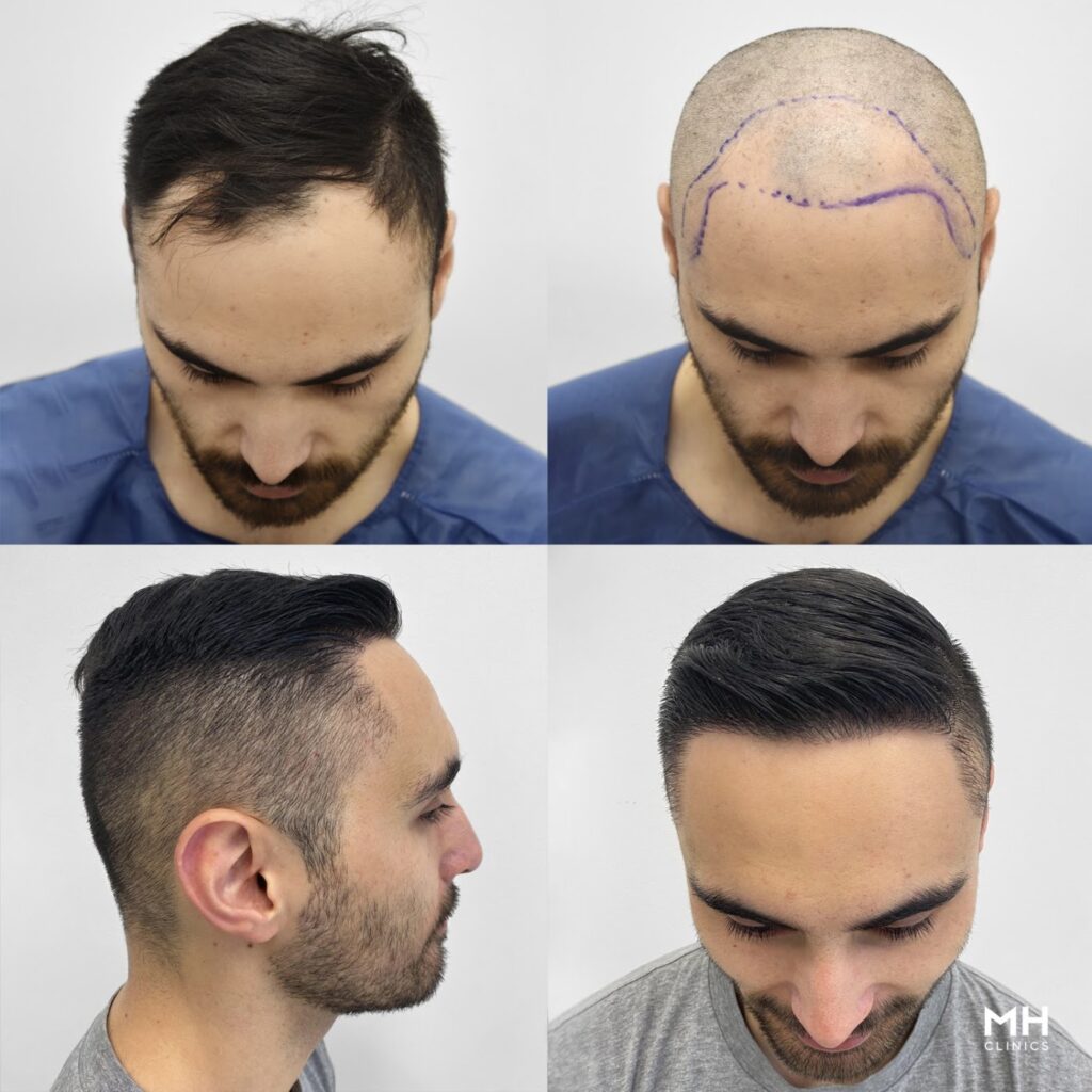 Medihair Hair Transplant Clinic gallery photo