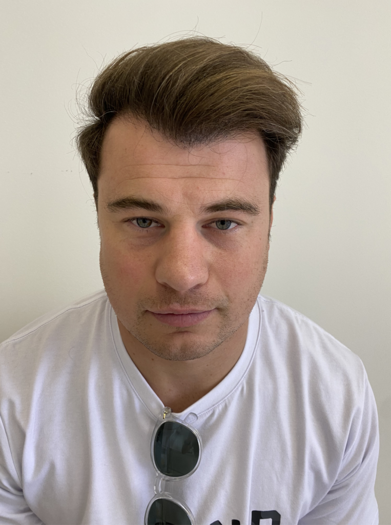 Medihair Hair Transplant Clinic gallery photo