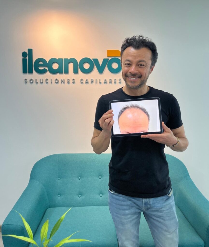 INJERTO CAPILAR ILEANOVO BOGOTÁ | IMPLANTE DE CABELLO ILEANOVO | TRASPLANTE CAPILAR ILEANOVO | INJERTO DE PELO gallery photo