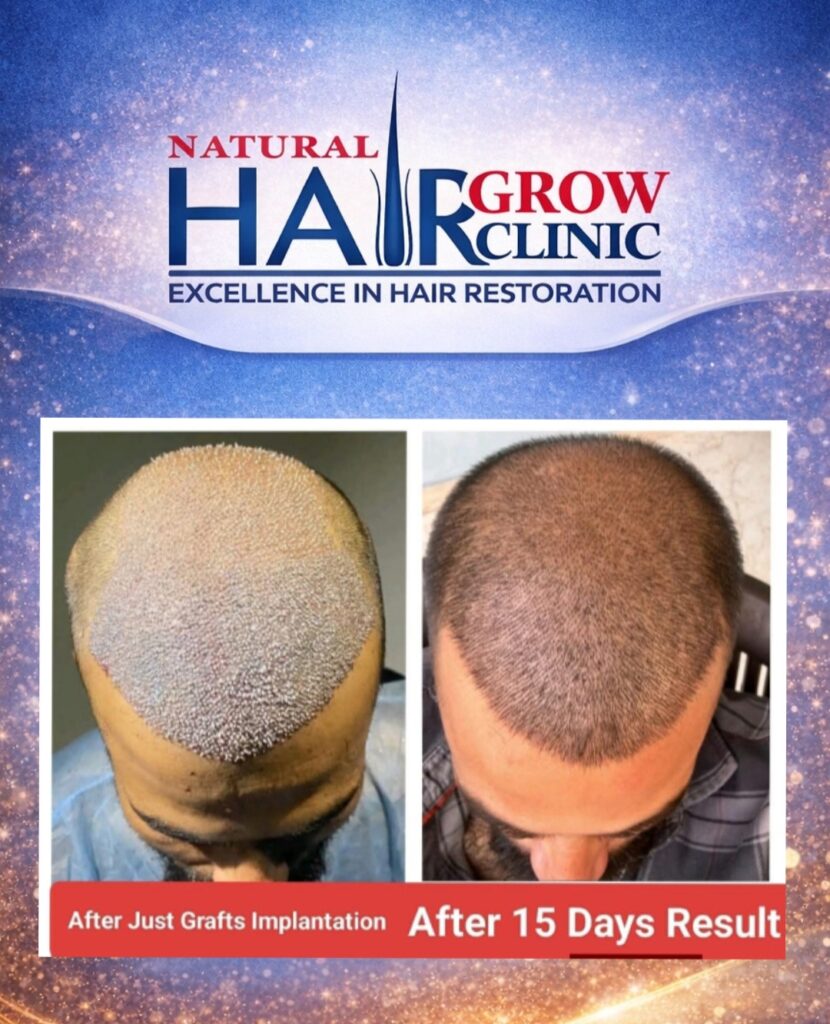 Natural Hair Grow Clinic gallery photo