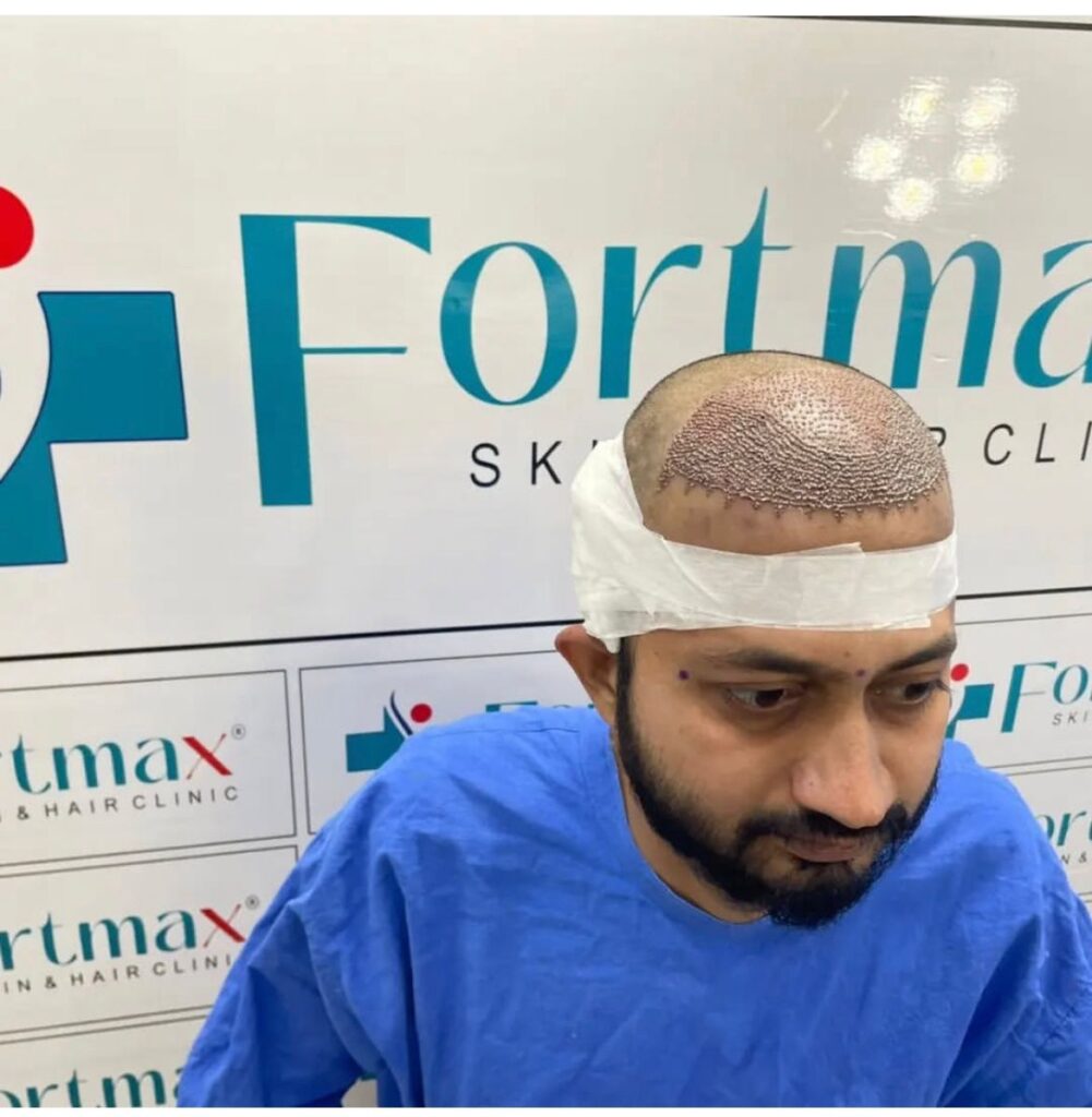 Fortmax Clinic Hair Transplant & Cosmetic Surgery in Jaipur gallery photo