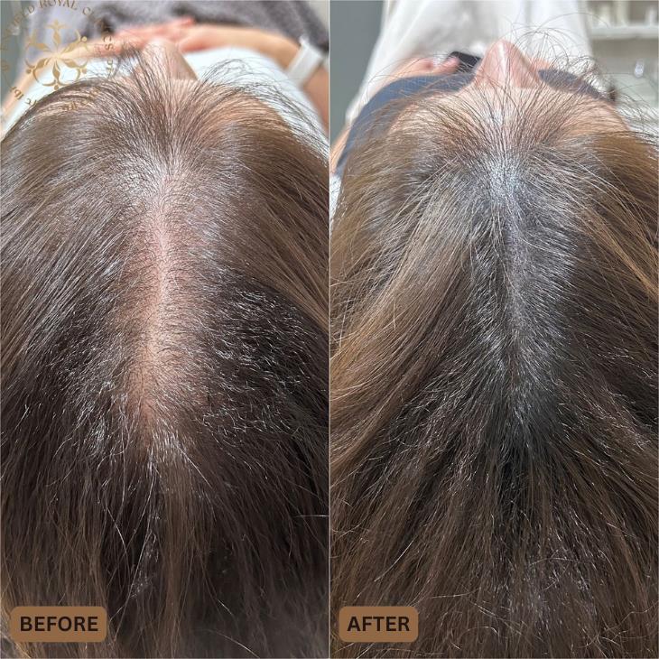 Dr Naveed Azhar – Hair Transplant in Islamabad | PRP Hair Treatment | Exosomes Therapy gallery photo
