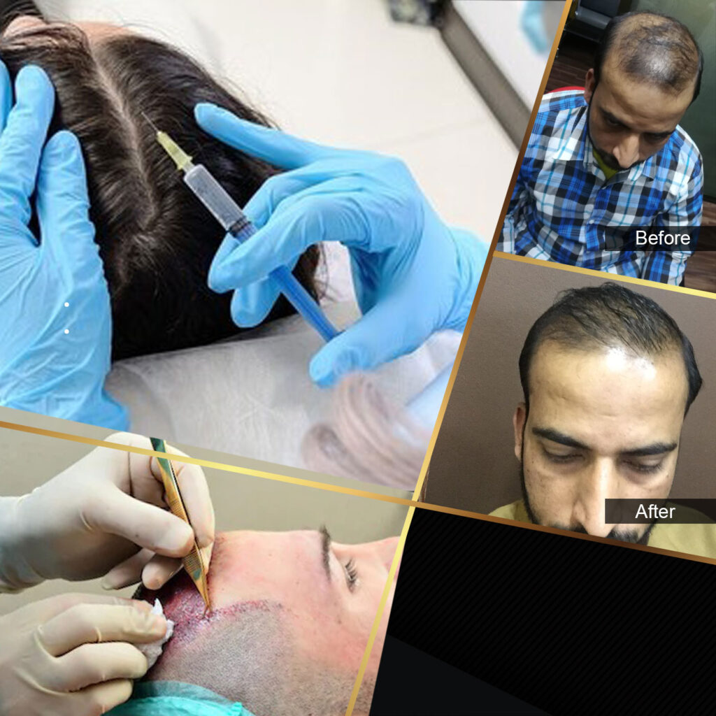 Hair Zone Care Center – Hair Replacement & Hair Transplant Lahore — clinic photo from Google Maps
