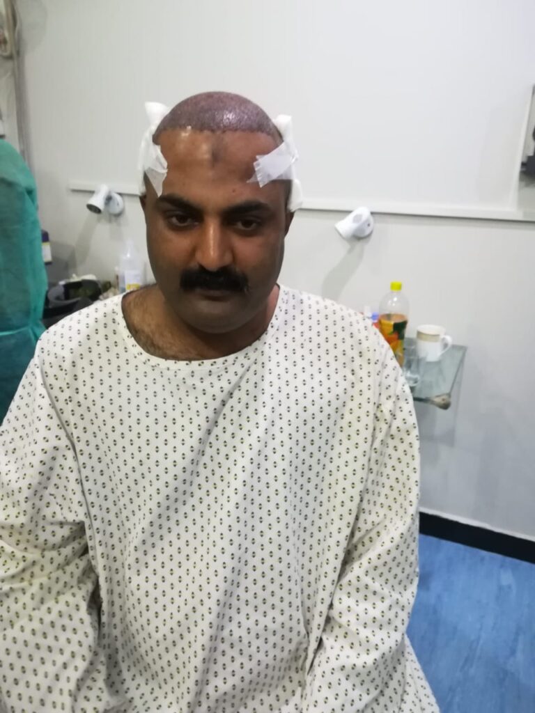 Hair Zone Care Center – Hair Replacement & Hair Transplant Lahore gallery photo