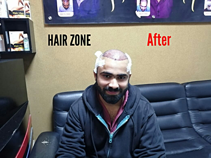 Hair Zone Care Center – Hair Replacement & Hair Transplant Lahore gallery photo