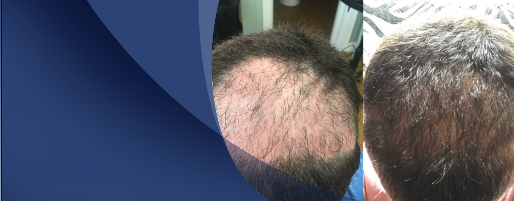 Hair Loss Control Clinic gallery photo