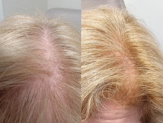 Hair Medicine Institute | Spencer Hawkins, MD gallery photo