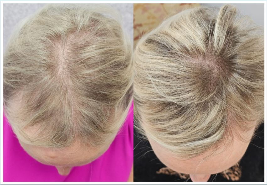 Hair Medicine Institute | Spencer Hawkins, MD gallery photo