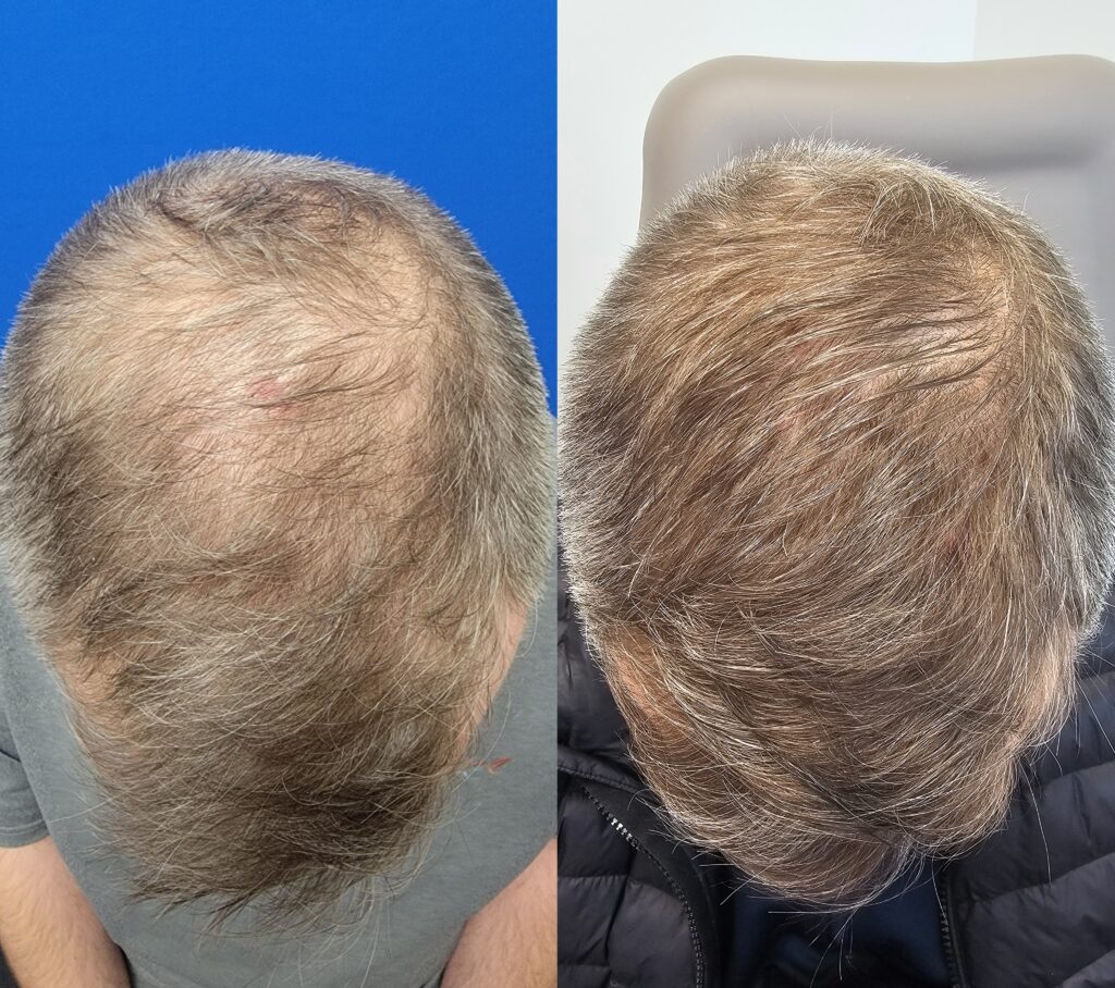 Hair Medicine Institute | Spencer Hawkins, MD gallery photo
