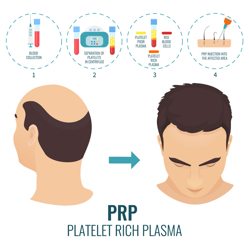 Hair Loss Treatment Center gallery photo