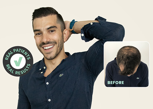 Hair Transplant Chicago from Solve gallery photo