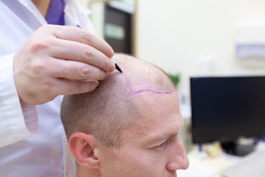 Cendant Stem Cell Hair Restoration and Transplant Clinic gallery photo