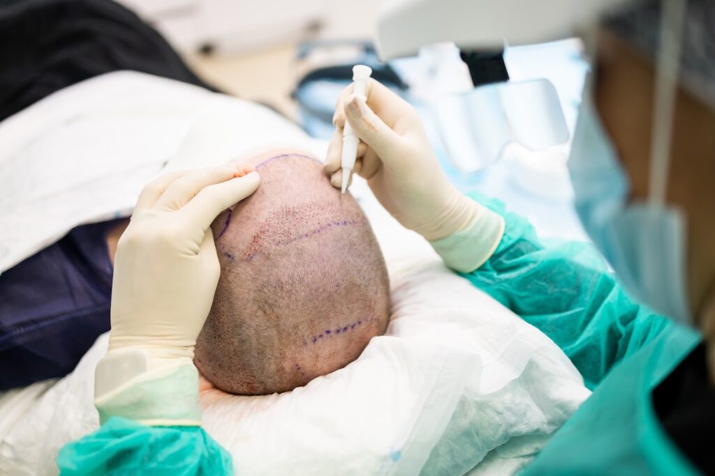 Cendant Stem Cell Hair Restoration and Transplant Clinic gallery photo