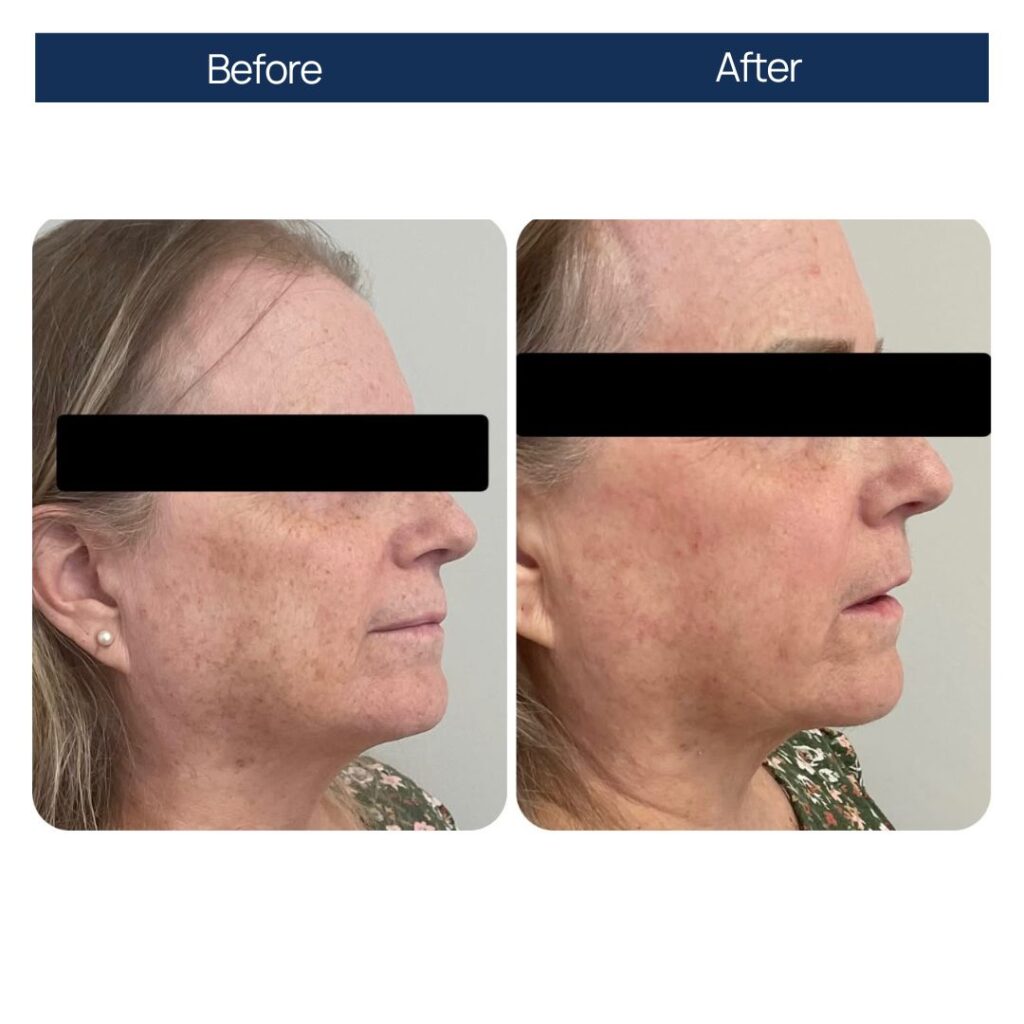 Reviva Hair & Skin Clinic gallery photo