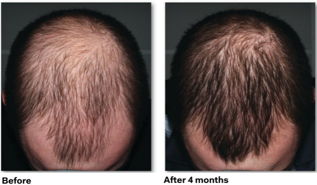 Reviva Hair & Skin Clinic gallery photo