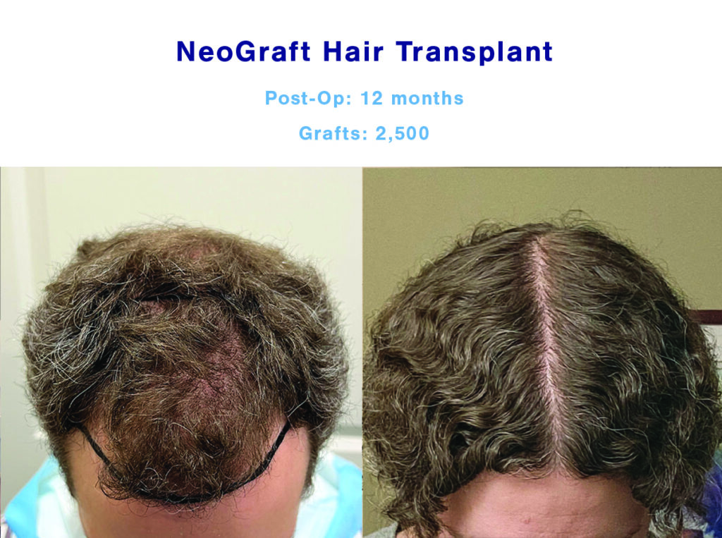 Louisville Hair Doctor gallery photo