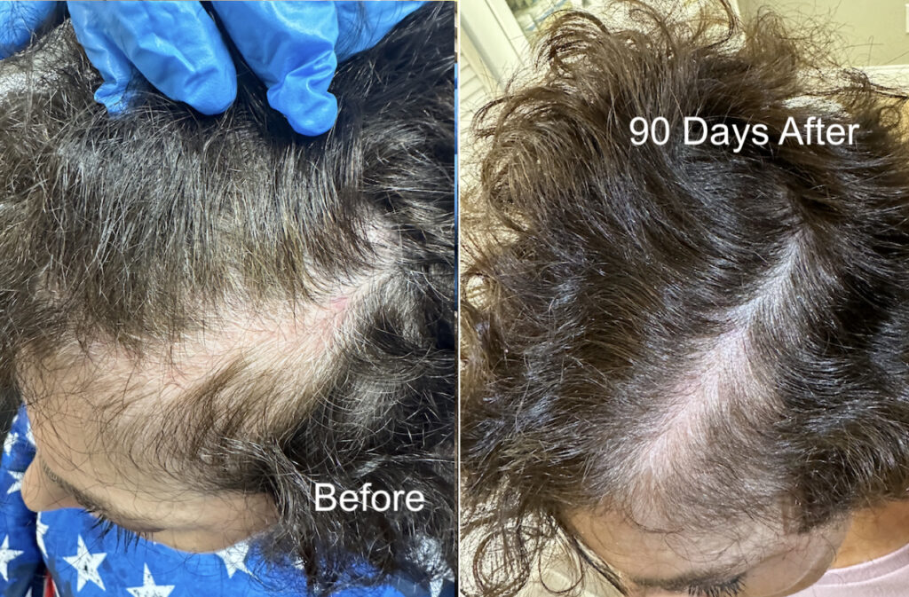 Hair Loss Heroes, Women’s Hair Growth Clinic gallery photo