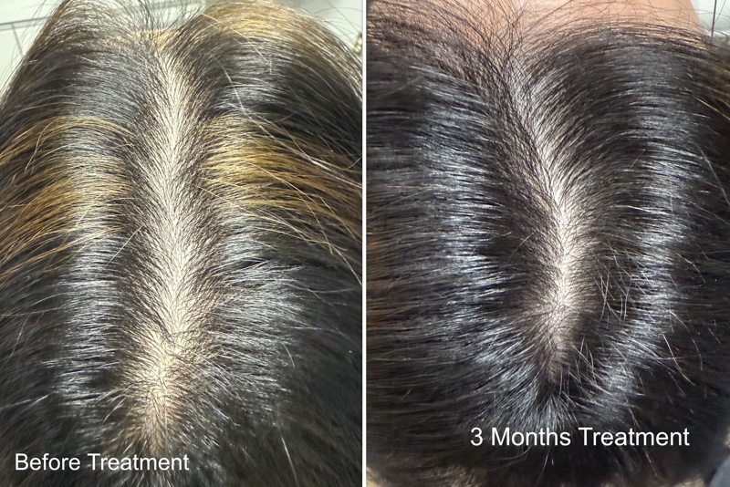 Hair Loss Heroes, Women’s Hair Growth Clinic gallery photo