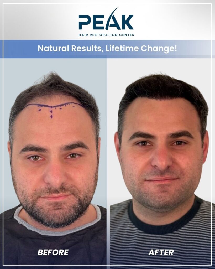 Peak Hair Restoration & Transplant Center- New York City gallery photo