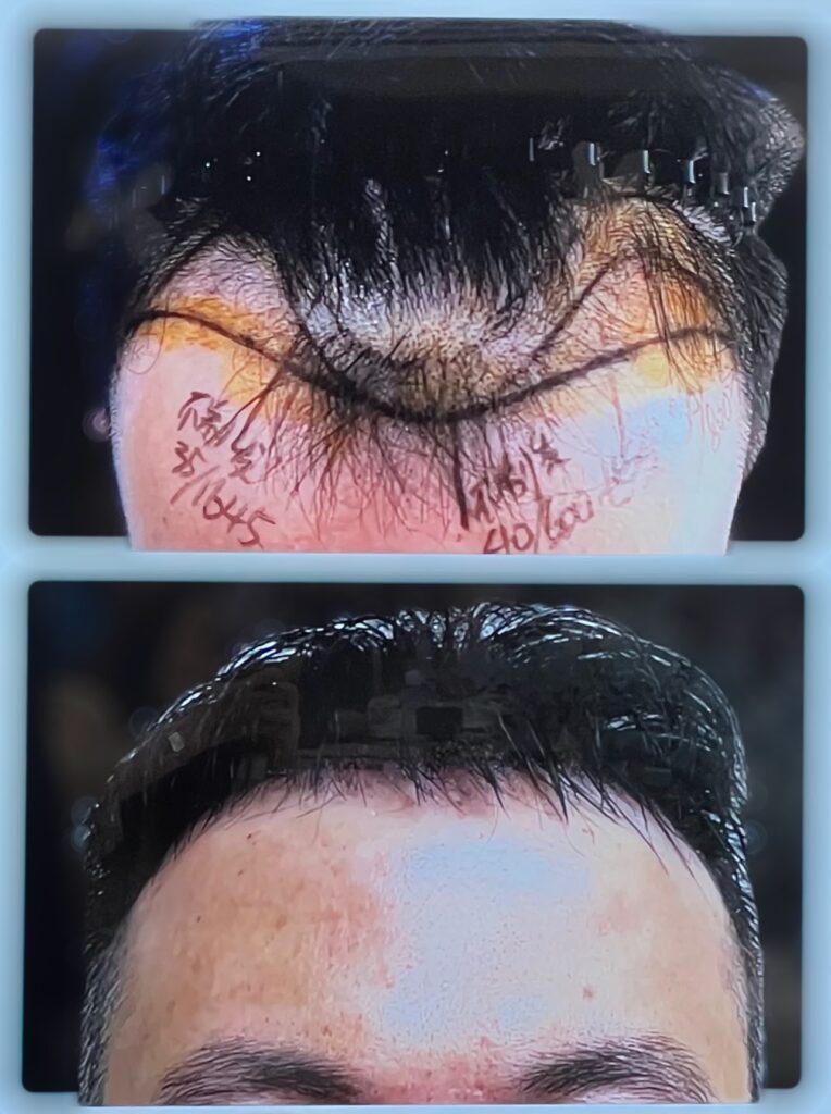 The Hair Mission gallery photo