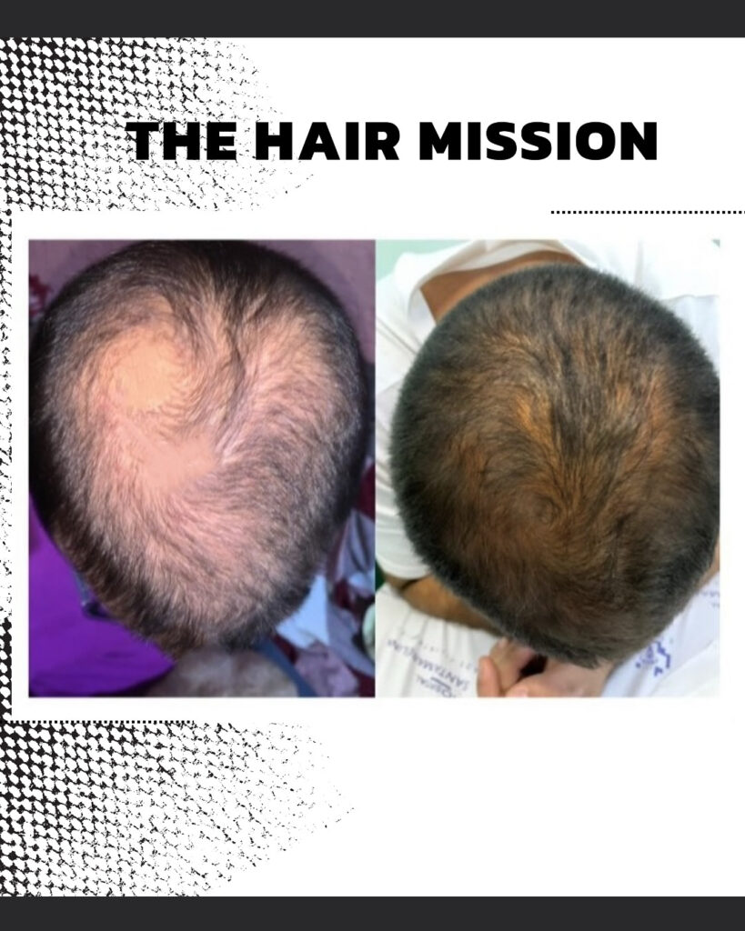 The Hair Mission gallery photo