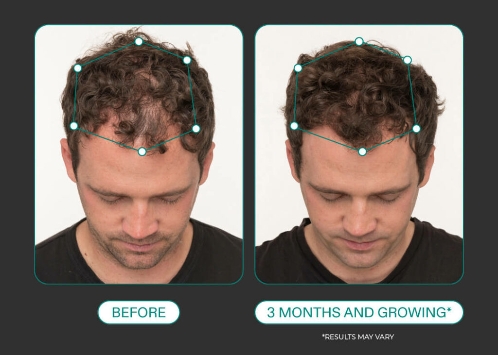 Dr Plano Hair gallery photo