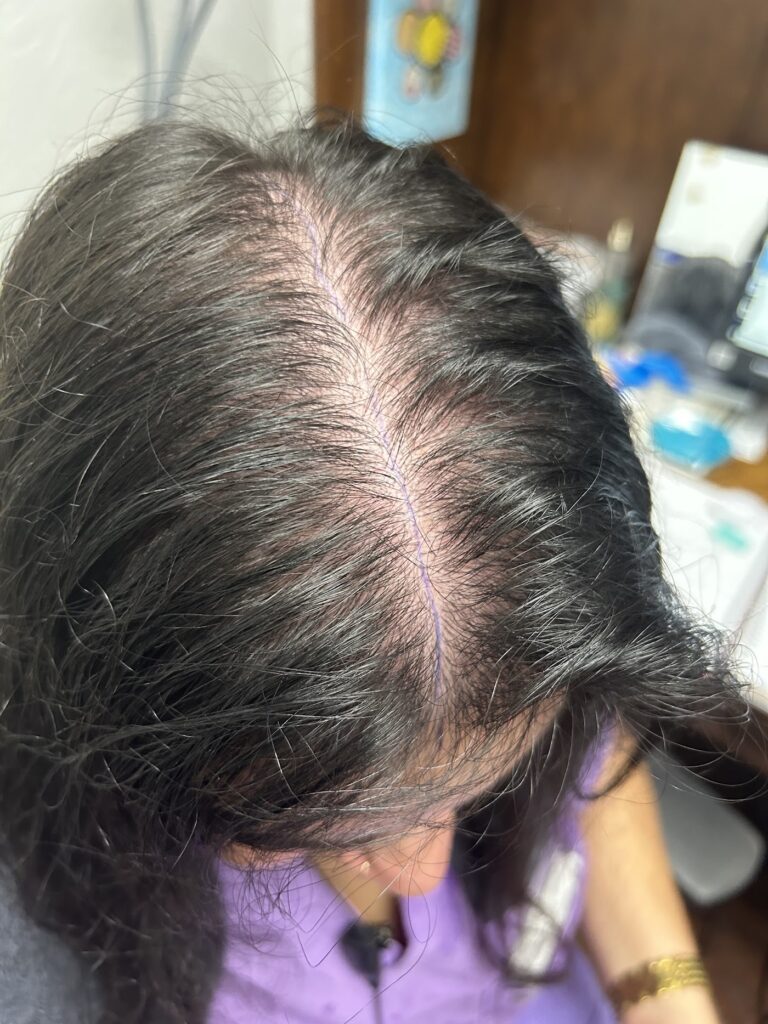 Dr Plano Hair gallery photo