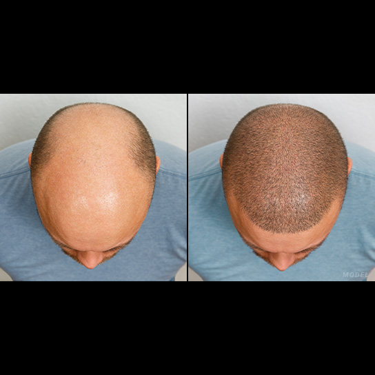 Premier Hair Restoration: Dr. Colin O’Dea gallery photo