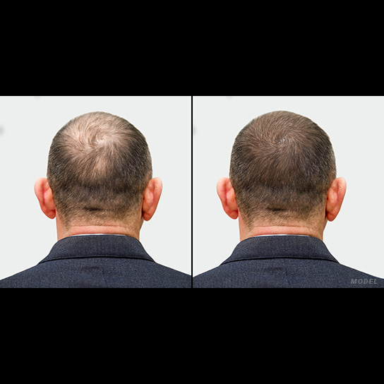 Premier Hair Restoration: Dr. Colin O’Dea gallery photo
