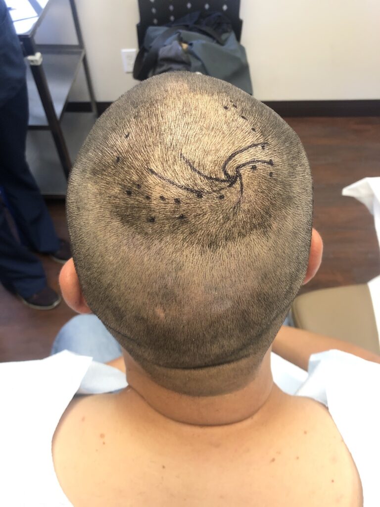 Concord Hair Restoration gallery photo