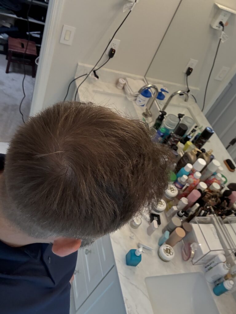 Advanced Hair Restoration gallery photo