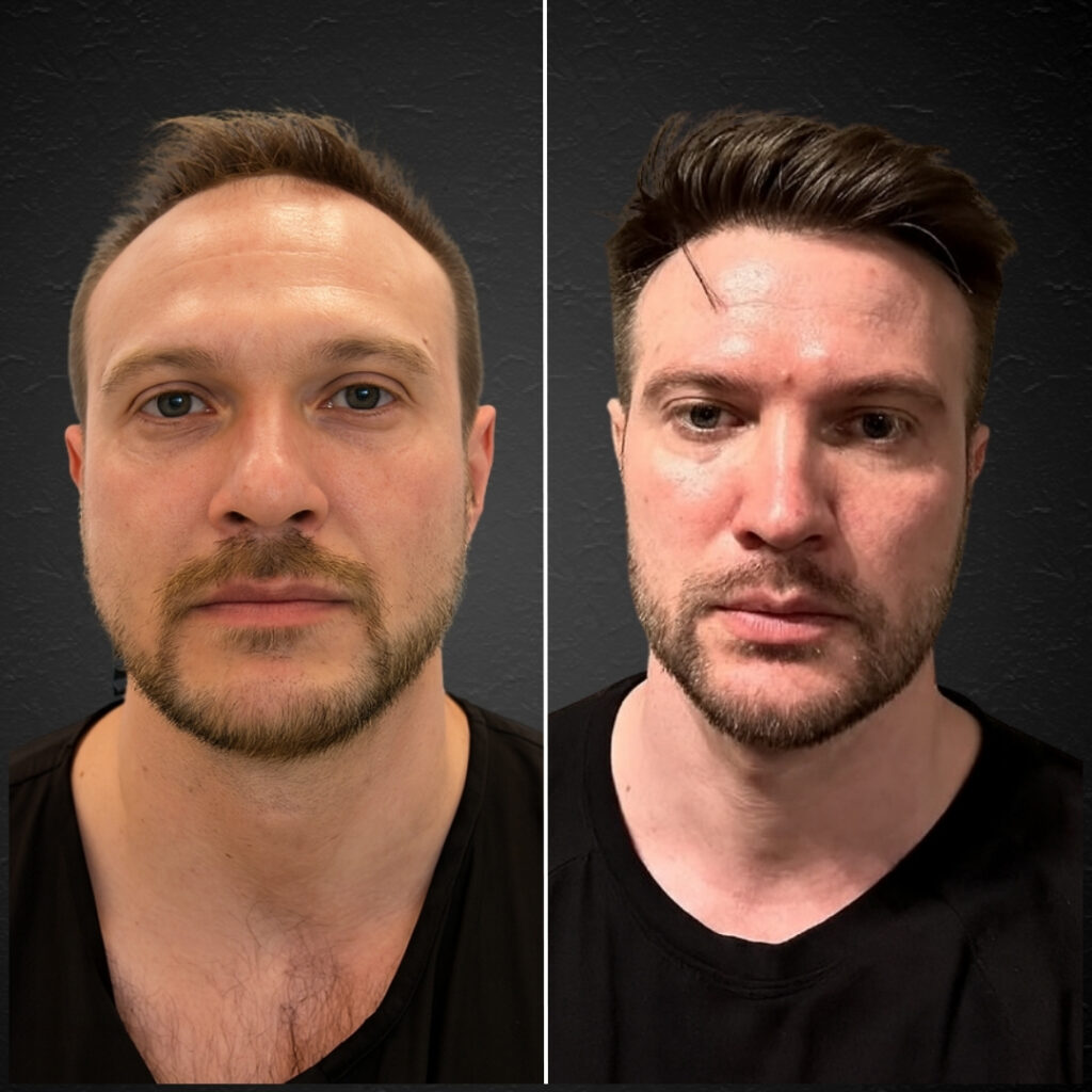Hair Transplant Design gallery photo