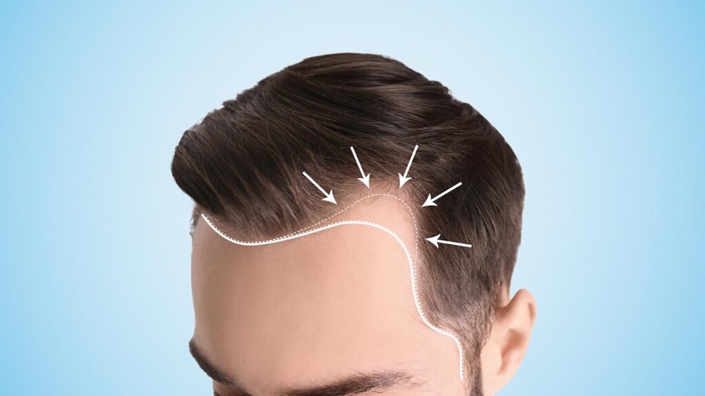 Hair Clinic Belgium gallery photo