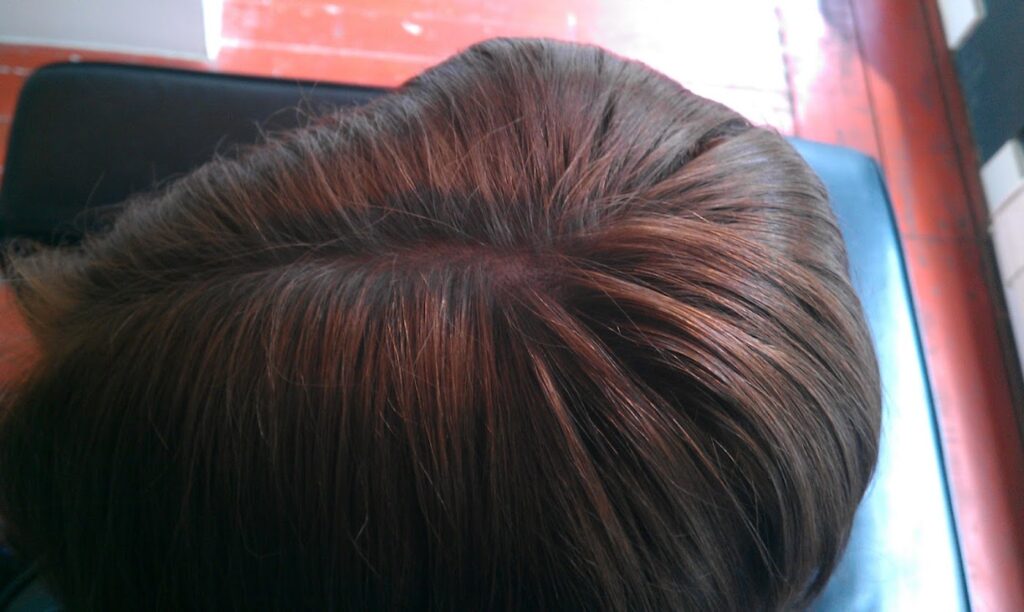 Pacific Hair Loss Solutions gallery photo