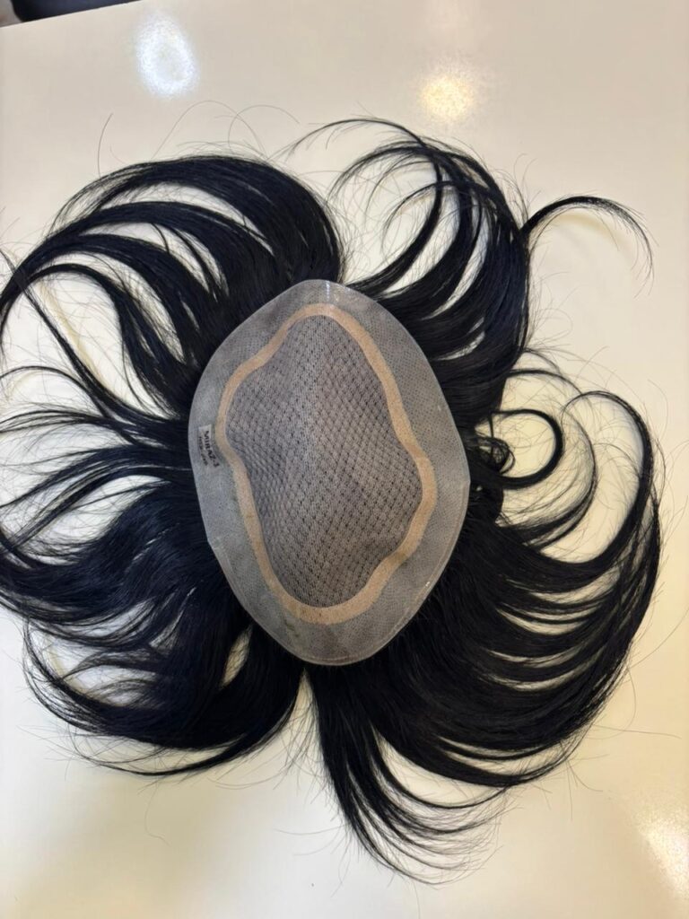 Advance Hair Clinic gallery photo