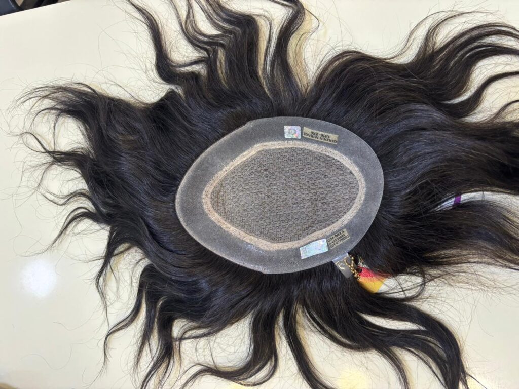 Advance Hair Clinic gallery photo