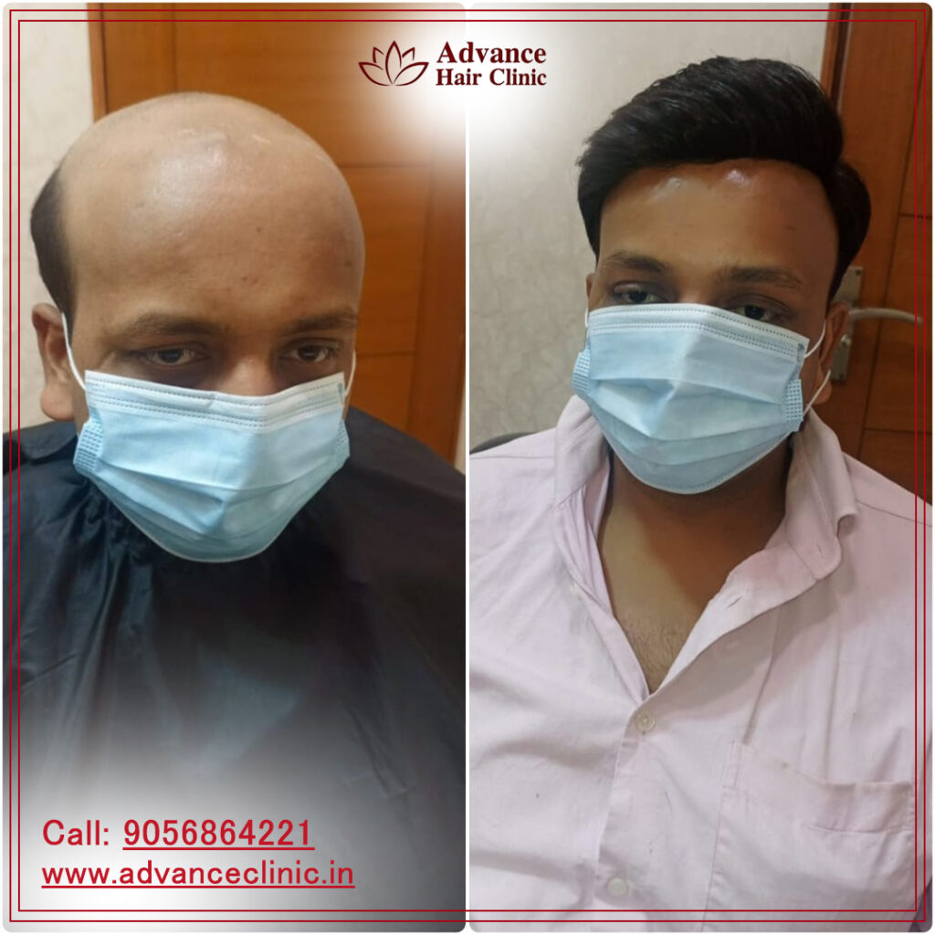 Advance Hair Clinic gallery photo
