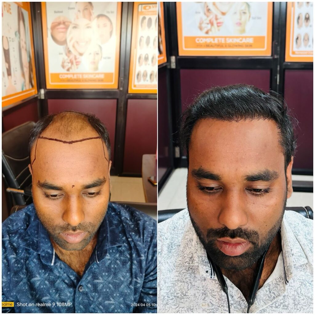 Hair Creations Bhubaneswar gallery photo