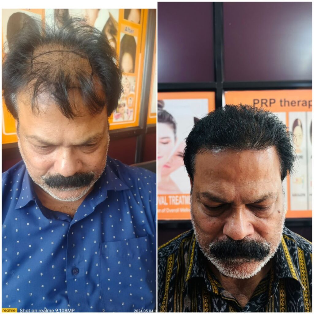 Hair Creations Bhubaneswar gallery photo