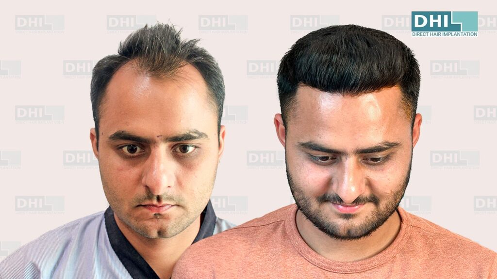 DHI Hair Restoration Clinic gallery photo