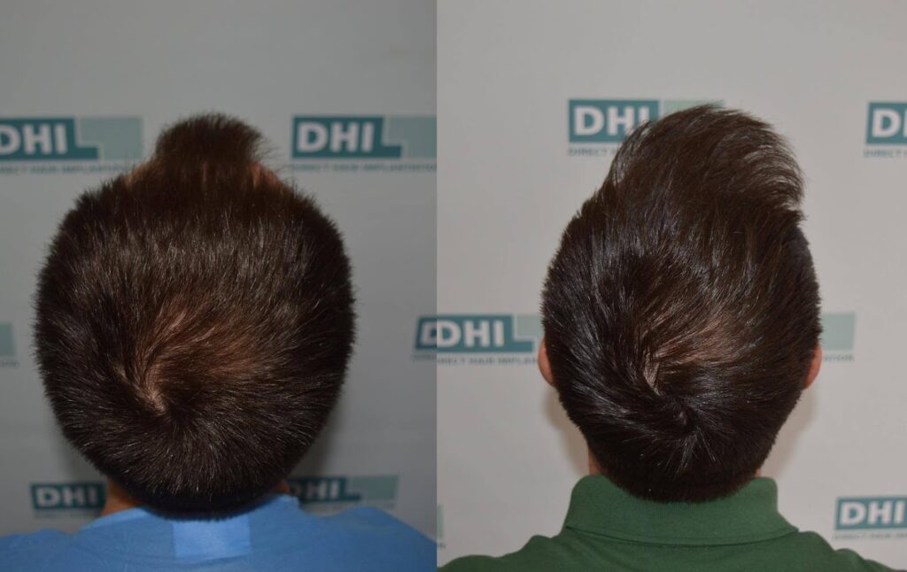 DHI Hair Restoration Clinic gallery photo