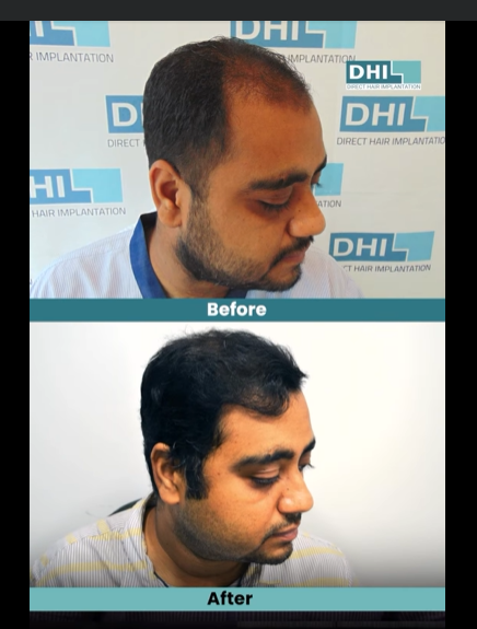 DHI Hair Restoration Clinic gallery photo