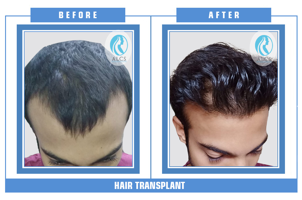 ALCS Hair Transplant and Cosmetic Clinic gallery photo