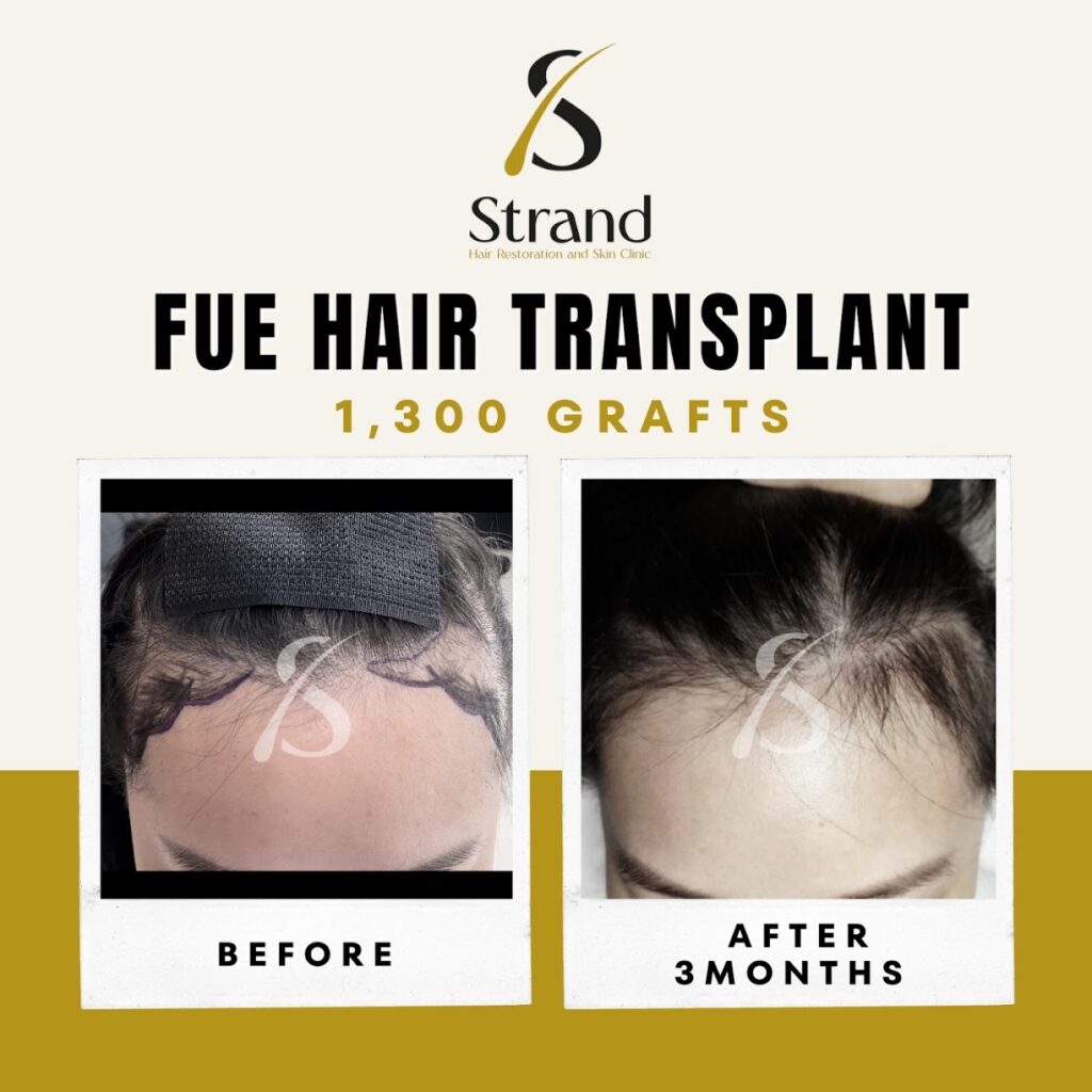 Strand Hair Restoration and Skin Clinic gallery photo