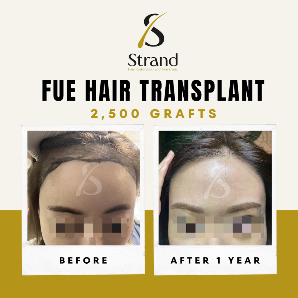 Strand Hair Restoration and Skin Clinic gallery photo