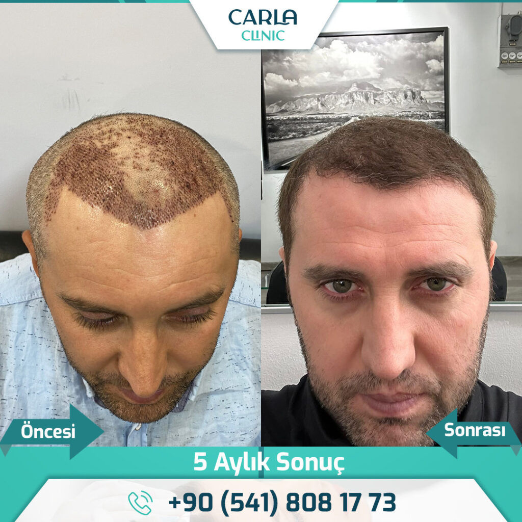Odio Clinic – Cidde Hair Transplant Center gallery photo