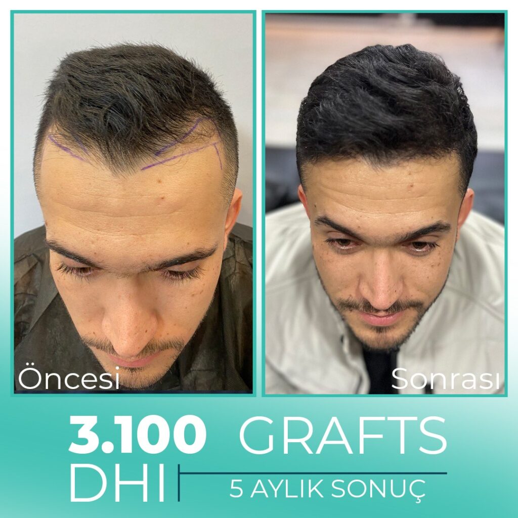 Odio Clinic – Cidde Hair Transplant Center gallery photo