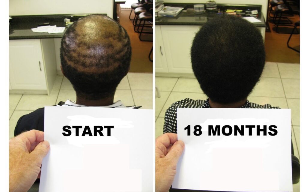 Dr Alexander’s Hair Loss Clinic gallery photo