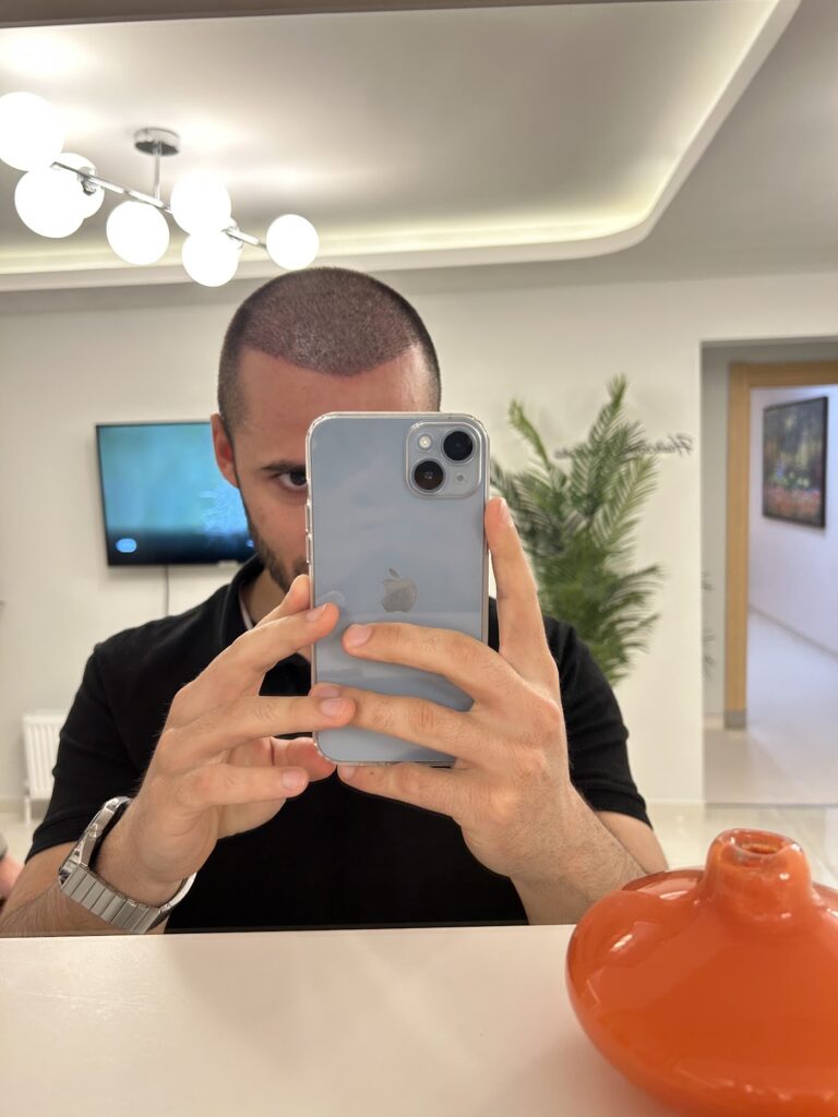 Egemen Güdül Hair Clinic Ankara Saç Ekim Merkezi Ankara gallery photo